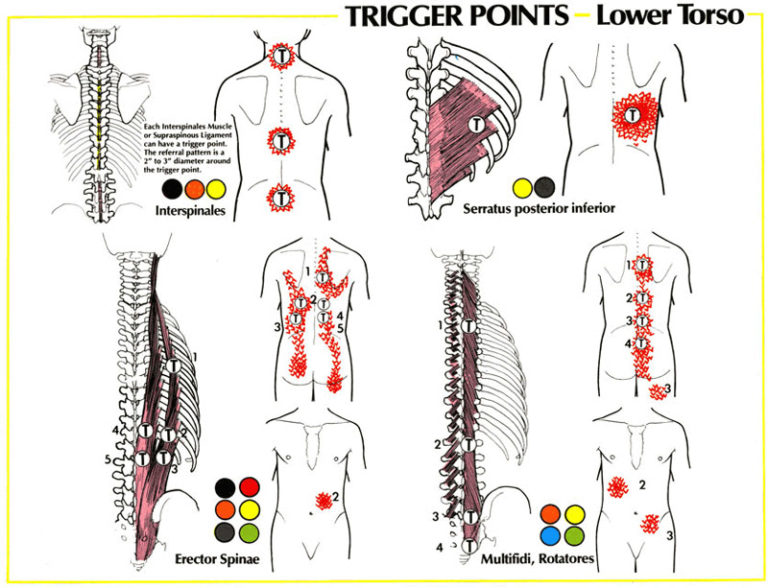 Back Pain GadiBody