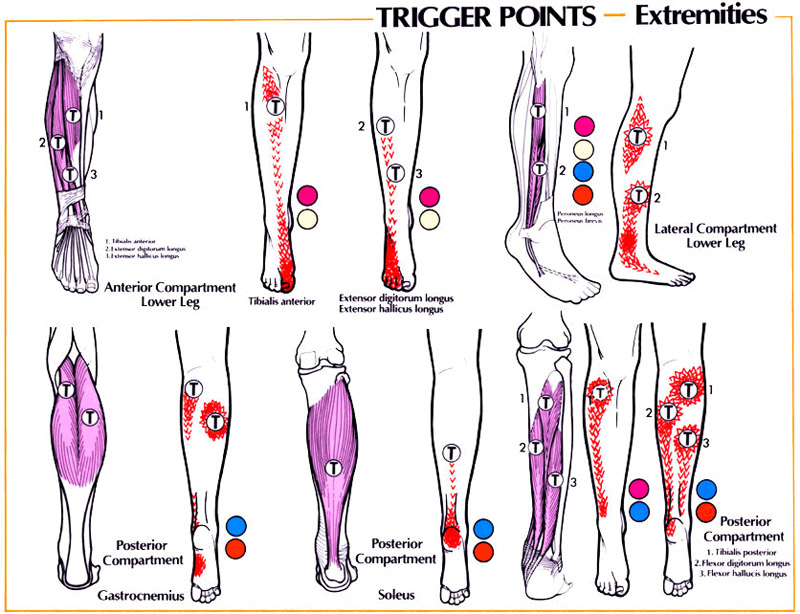 Knee Trigger Point Charts